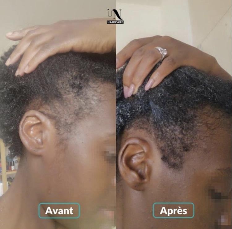 Before and after Hair Growth Cure 1 month